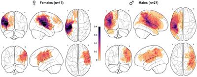 Brain growth until adolescence after a neonatal focal injury: sex related differences beyond lesion effect